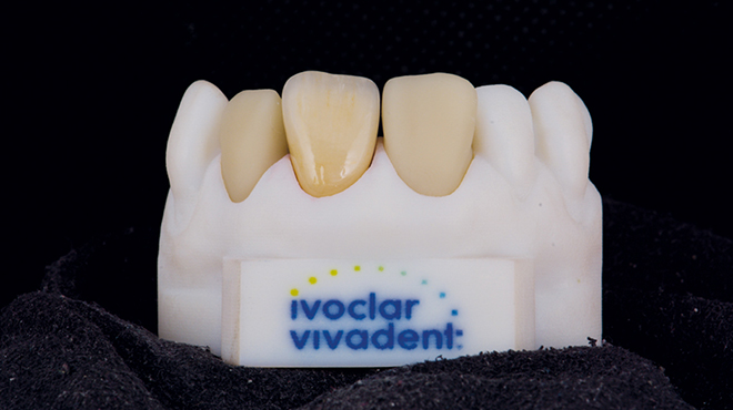 Ocenění Dental Technician Progress Award od Ivoclar Vivadent