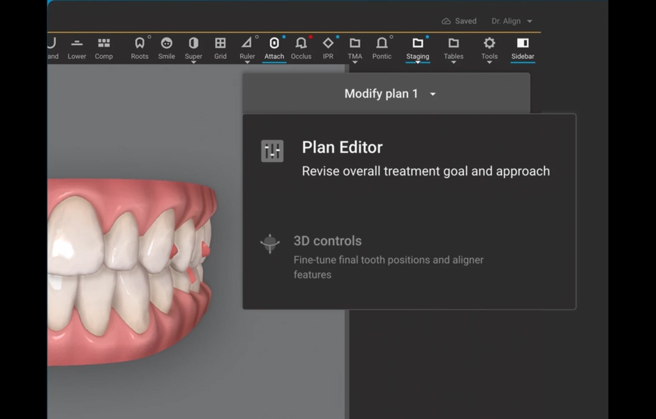 Obr. 4: Plan Editor a 3D Controls nabízejí možnost úprav v reálném čase, což umožňuje lékařům přesněji přizpůsobit léčebné plány individuálním potřebám pacienta.