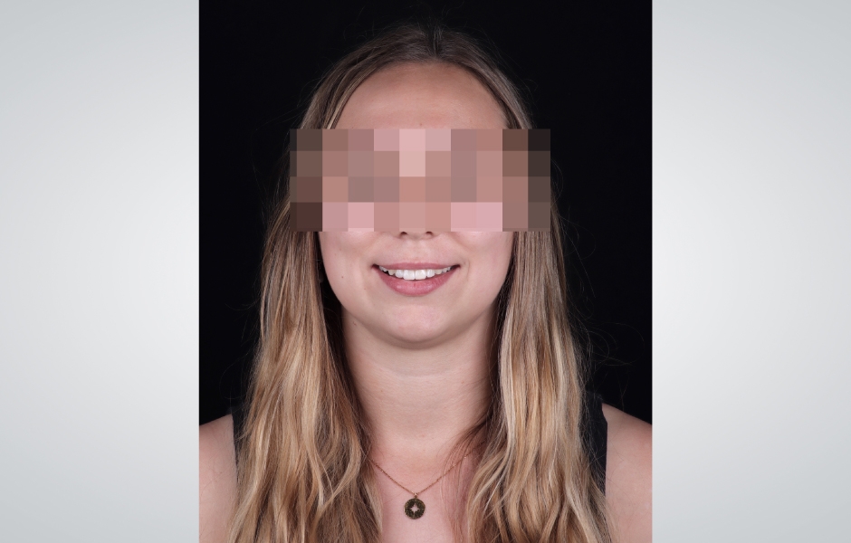 Obr. 12: Upřímný a autentický úsměv pacientky na konci léčby.