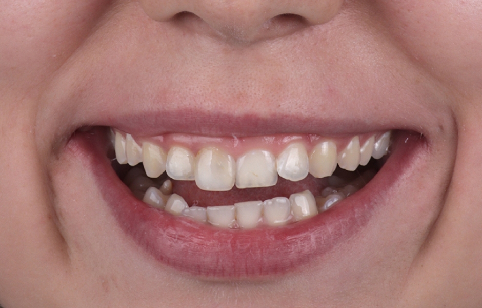 Obr. 3: Estetická analýza musí zahrnovat obličej, nikoli pouze zuby.