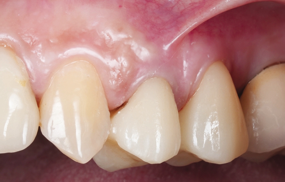 Obr. 11: Konečný klinický výsledek.