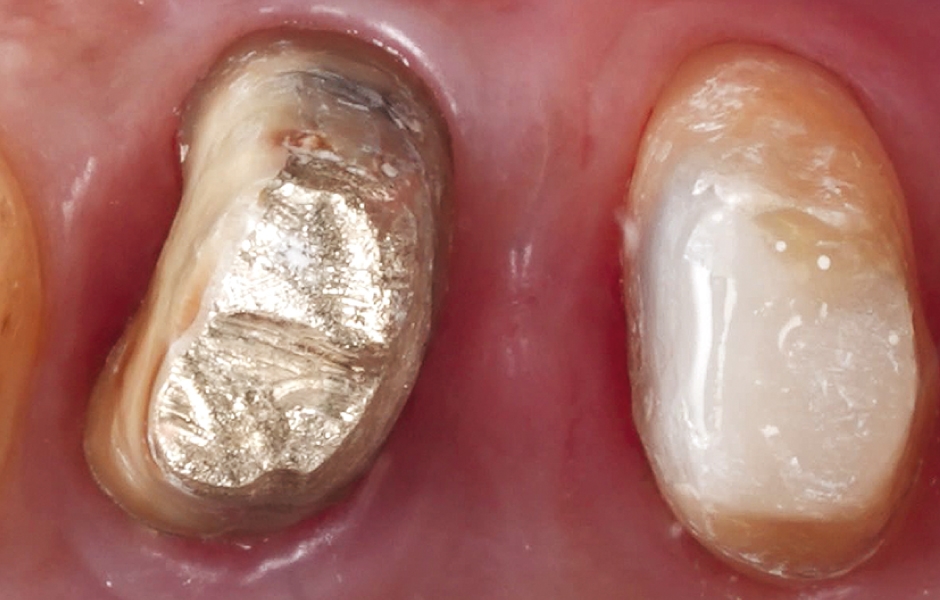 Obr. 4: Situace před zhotovením otisku.