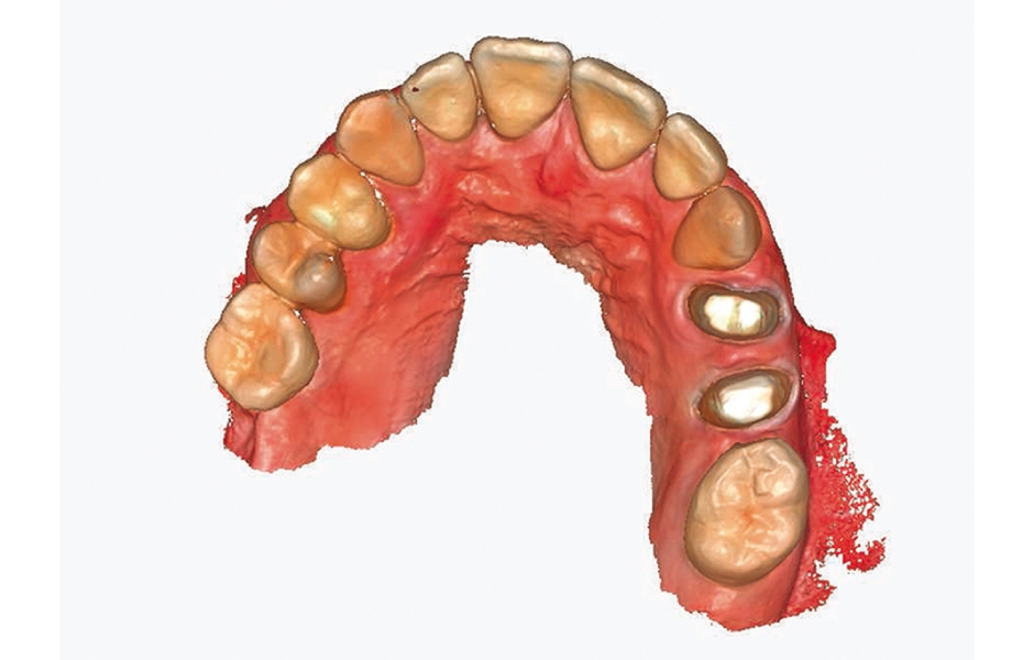 Obr. 5: Digitální otisk.