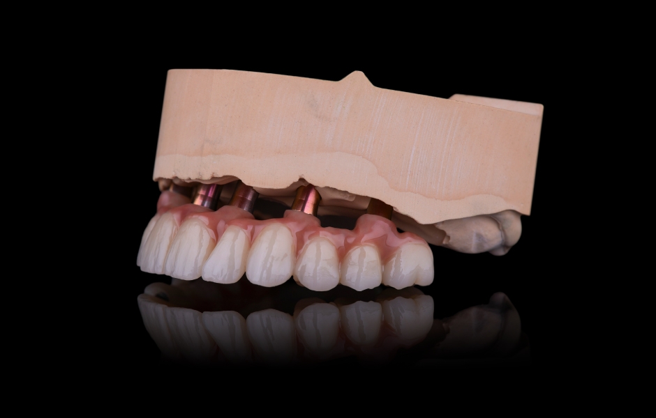 Obr. 25: Laterální pohled zleva a zprava na definitivní rekonstrukci.