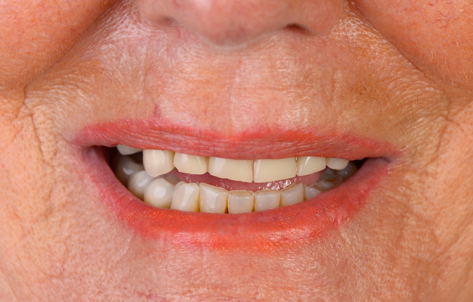 Obr. 30: Spokojená a (opět) veselá pacientka.