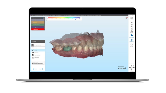 Align Technology představuje iTero™ Design Suite pro 3D tisk v ordinaci