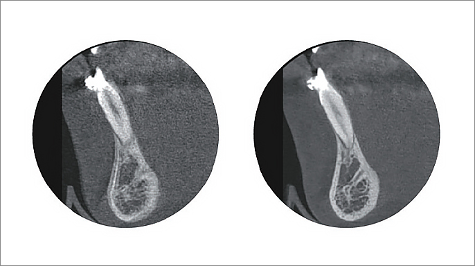 CBCT 3D rentgeny KaVo ProXam: špičkové nástroje pro moderní stomatologii