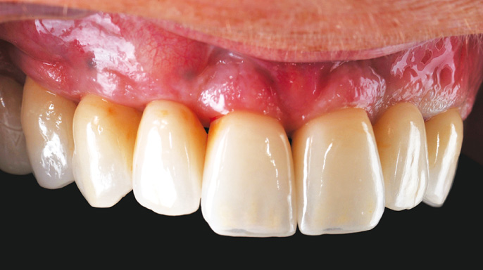 Digitální workﬂow v dentálních technologiích