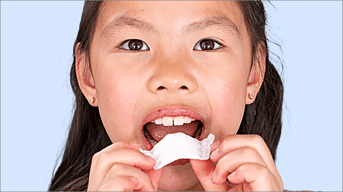 Align Technology uvedla v Evropě systém Invisalign Palatal Expander Align Technology uvedla v Evropě systém Invisalign Palatal Expander