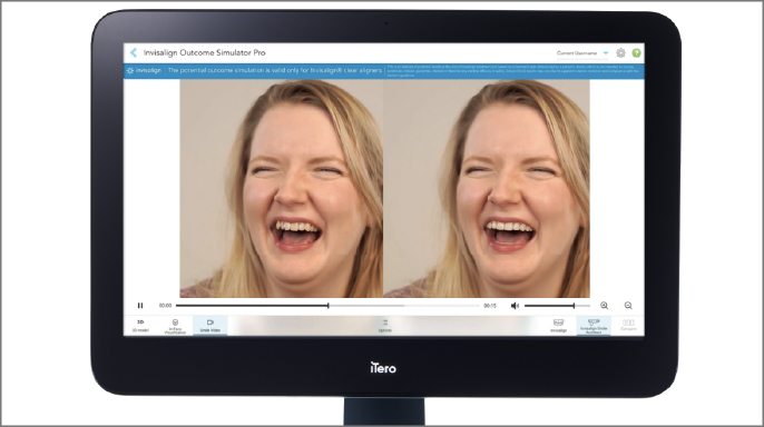 Align Technology představuje inovace pro iTero™ Digital Solutions ekosystém Align Technology představuje inovace pro iTero™ Digital Solutions ekosystém