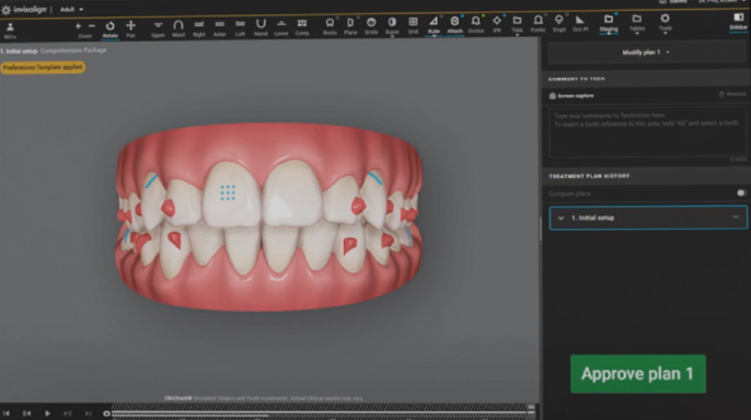 ClinCheck signature experience: Cesta zubního lékaře k digitálnímu mistrovství ClinCheck signature experience: Cesta zubního lékaře k digitálnímu mistrovství