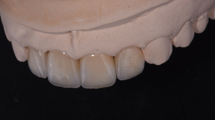 Cesta k novému úsměvu: kazuistika Cesta k novému úsměvu: kazuistika