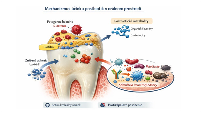 Postbiotiká v regulácii patobiontov orálneho mikrobiómu: nové perspektívy pre dentálnu hygienu Postbiotiká v regulácii patobiontov orálneho mikrobiómu: nové perspektívy pre dentálnu hygienu