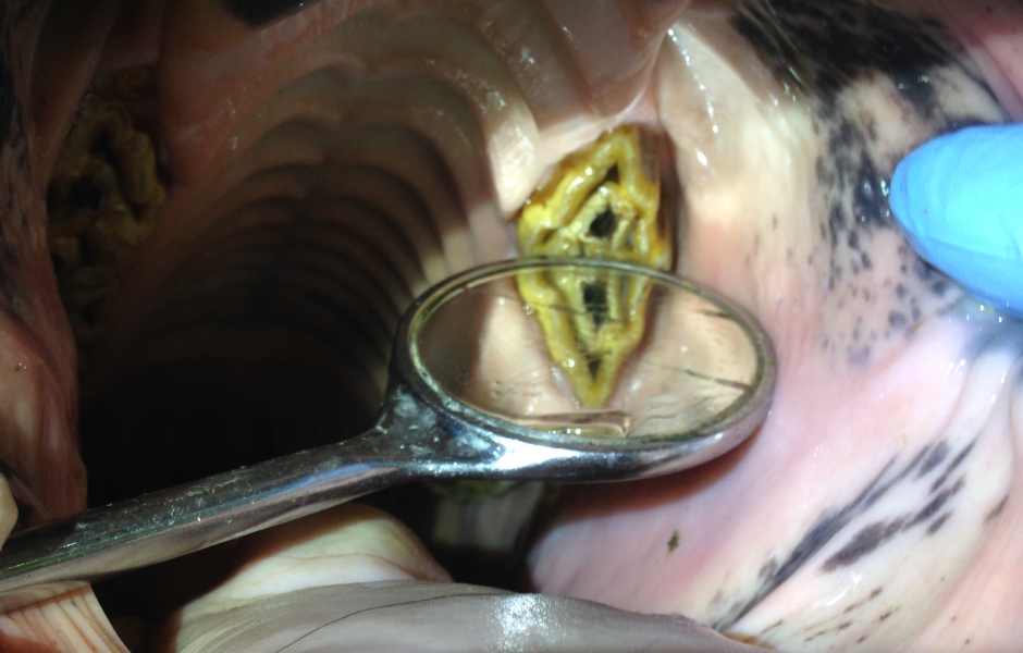 Restorativní ošetření infundibulárních kazů