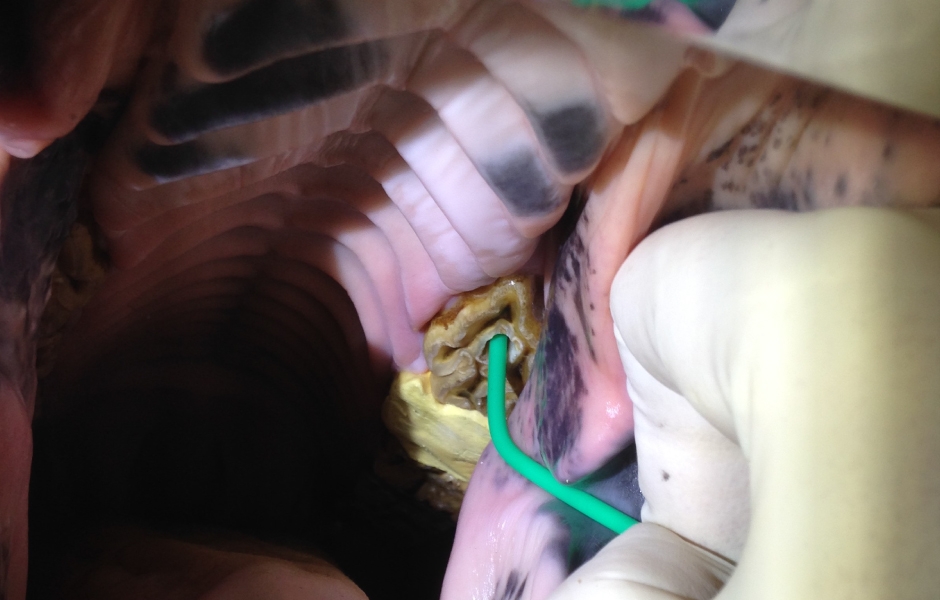 Restorativní ošetření infundibulárních kazů