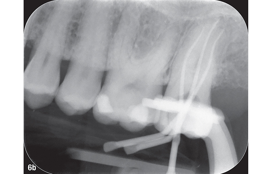 6b: Rentgenový snímek.