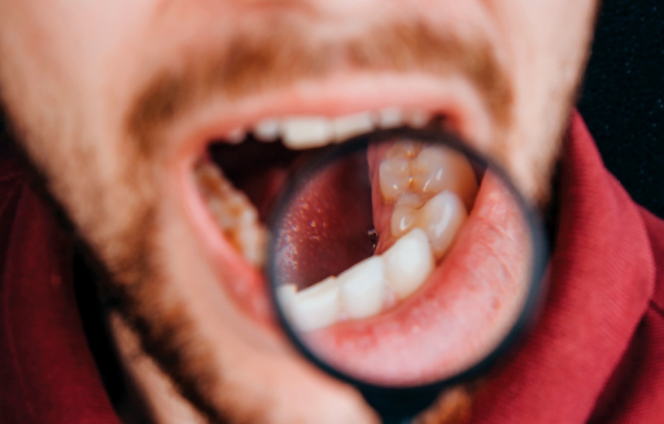 Význam včasné diagnostiky rakoviny dutiny ústní