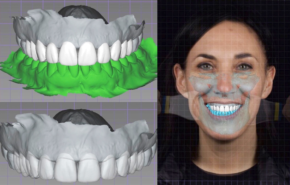Obr. 2a–c: Digital Smile Design zhotovený dle CBCT