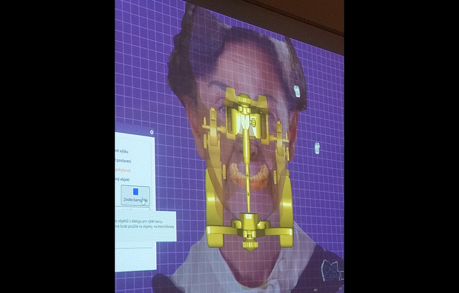 Projekt Erasmus na VOŠZ a SZŠ a Gymnázium, Alšovo nábřeží 6, Praha 1