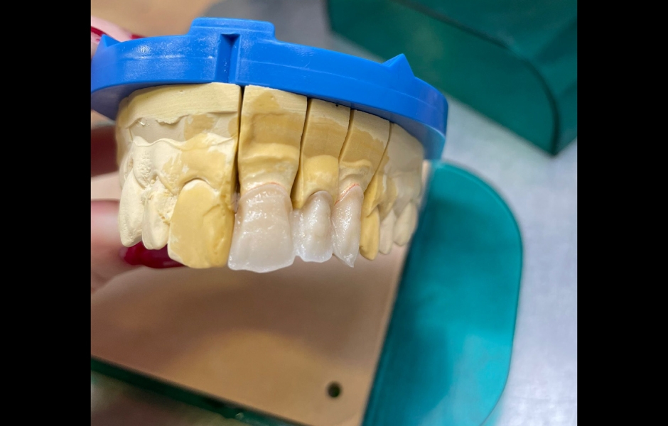 Projekt Erasmus na VOŠZ a SZŠ a Gymnázium, Alšovo nábřeží 6, Praha 1