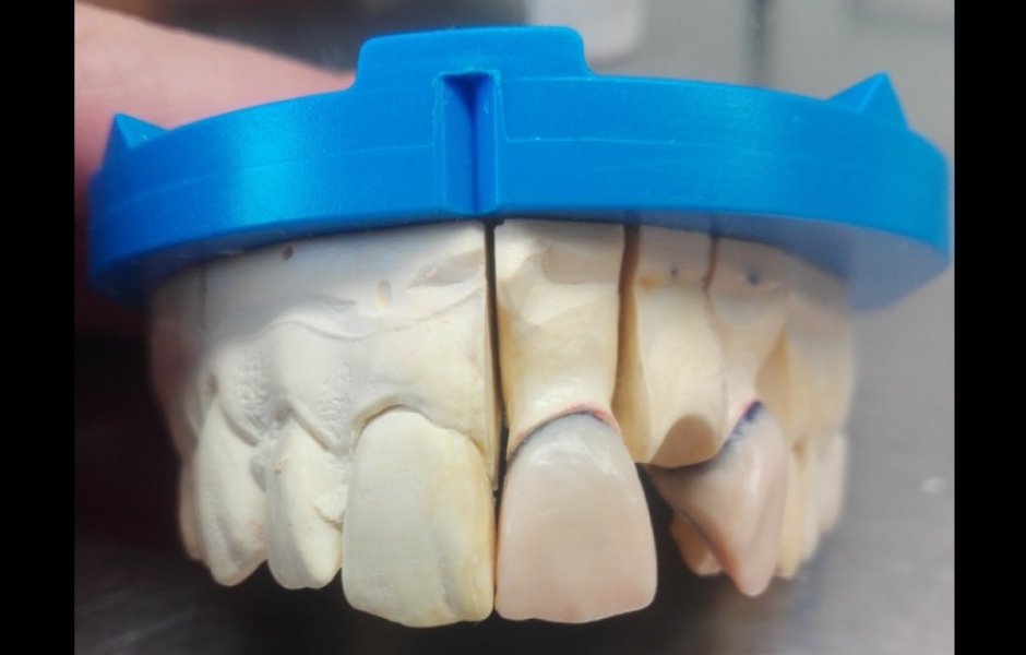 Projekt Erasmus na VOŠZ a SZŠ a Gymnázium, Alšovo nábřeží 6, Praha 1