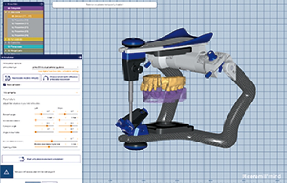 Obr. 10: Virtuální artikulátor Ceramill Artex.