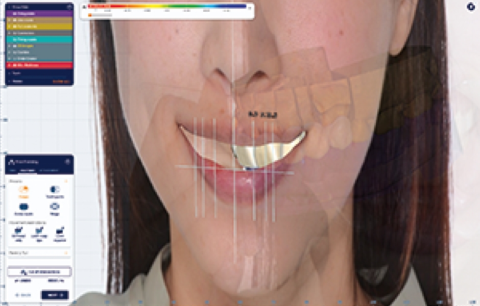 Obr. 16: Ceramill M-Smile – pohled z úhlu.