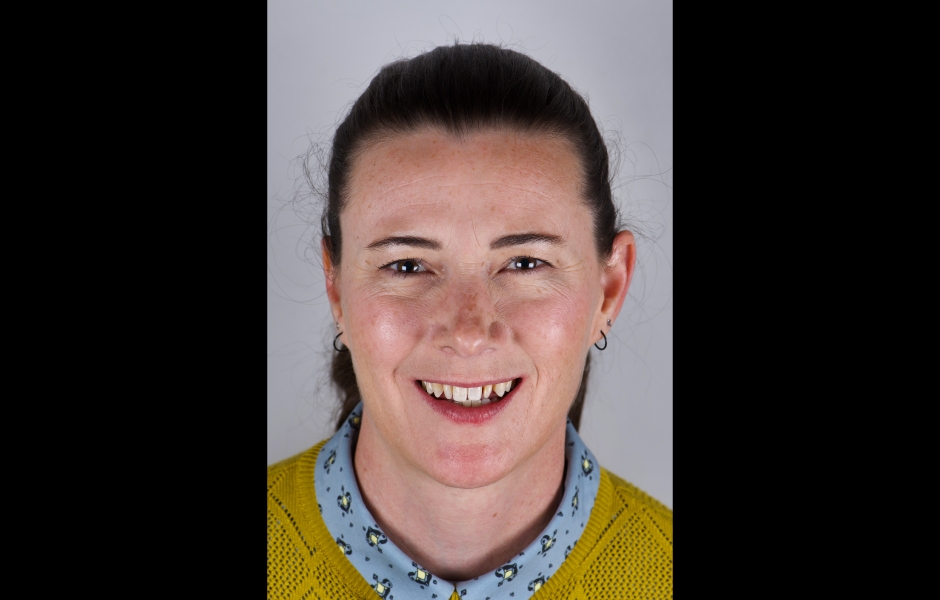 Obr. 22: Po dokončení protetické rekonstrukce bylo patrné pozoruhodné estetické zlepšení – lepší harmonie úsměvu, vyvážená dominance centrálních řezáků a dokonalá integrace s obličejem. Finální snímky zdůrazňují výsledek – dosažení přirozeného a harmonick