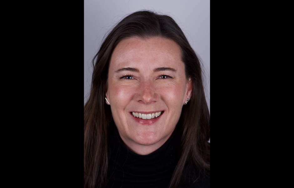 Obr. 23: Finální snímky zdůrazňují výsledek – dosažení přirozeného a harmonického úsměvu.