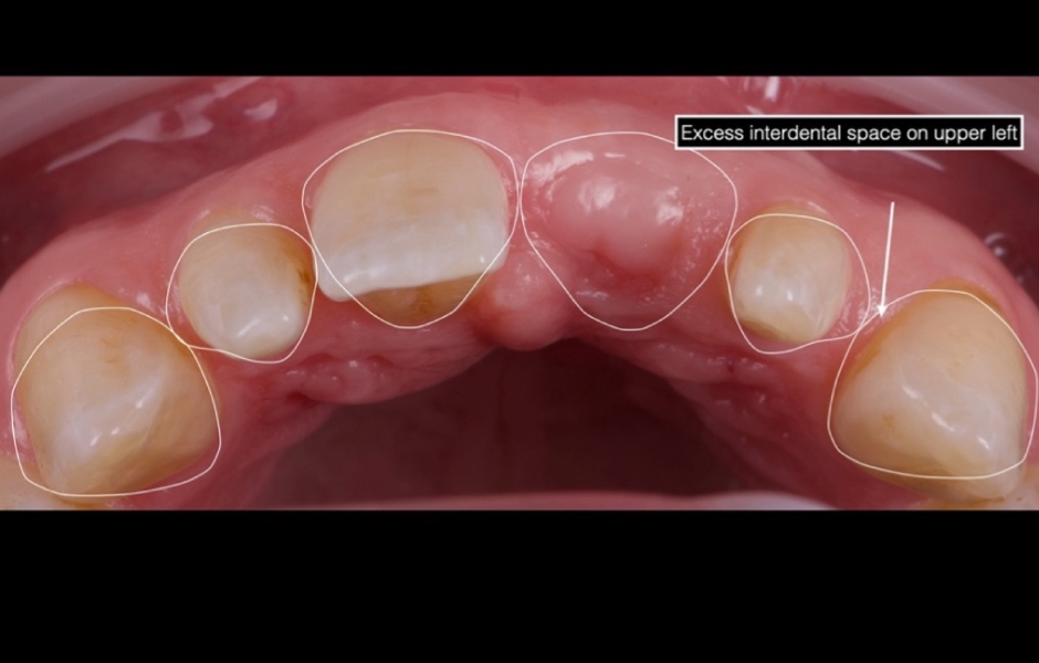 Obr. 6: Digital Smile Design (DSD) a 2D mock-up usnadnily vizualizaci navrhovaných změn.
