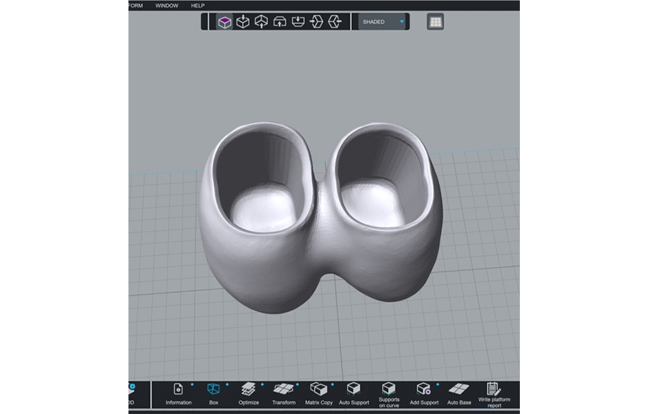 Obr. 13: STL soubor finální náhrady připravený k tisku.