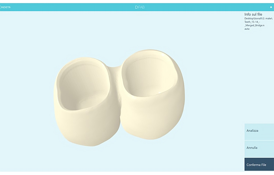 Obr. 14. Nahrání STL souboru náhrady do softwaru Nauta Photoshade od DWS Systems.