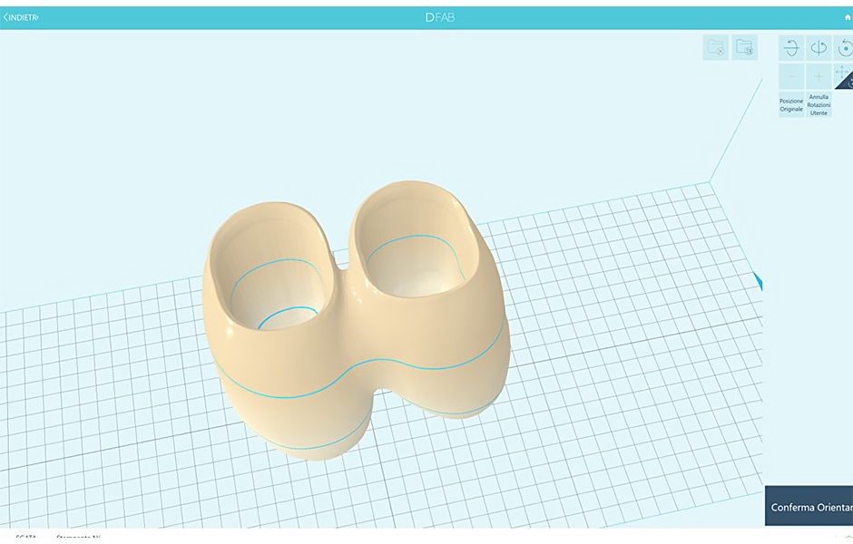 Obr. 16: Detail virtuální náhrady připravené k automatické tvorbě tiskových podpěr v Nauta Photoshade.