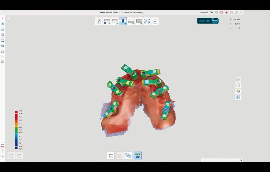 Obr. 14: Digitální workflow Medit SmartX pro intraorální skenování celé čelisti pomocí Medit i900 a softwaru Medit Scan for Clinics (verze 1.13.2).