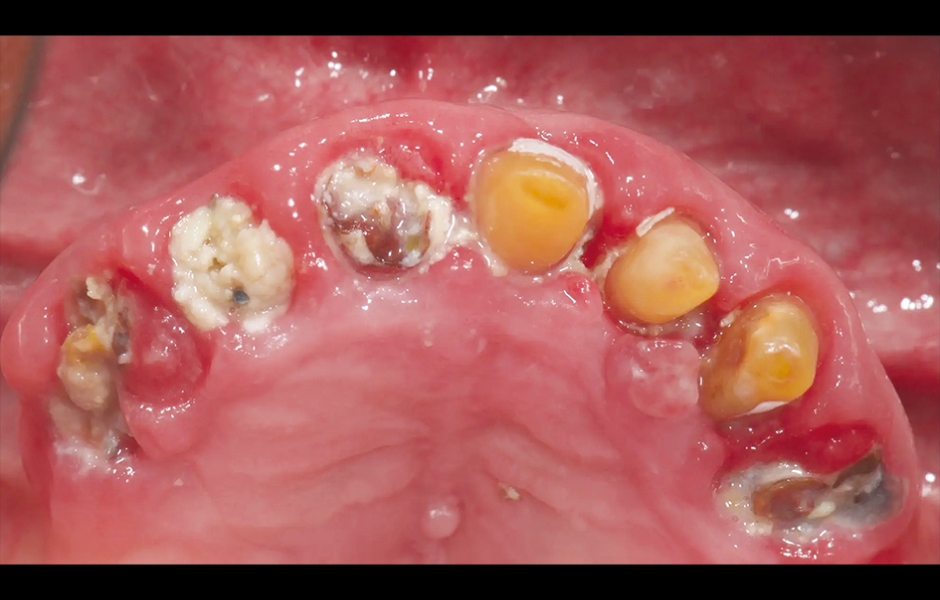 Obr. 2: Výchozí situace, okluzální pohled.