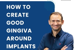 How to Create Good Gingiva Around Implants