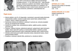 Jak na reendodoncii jednoduše a prakticky