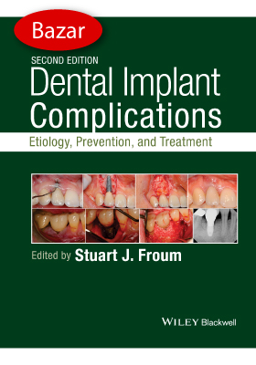 Dental Implant Complications: Etiology, Prevention, and Treatment