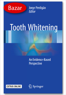 Tooth Whitening – bazar